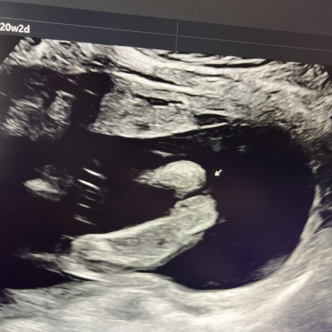 Photo shared by Cole for their Babylist baby registry.