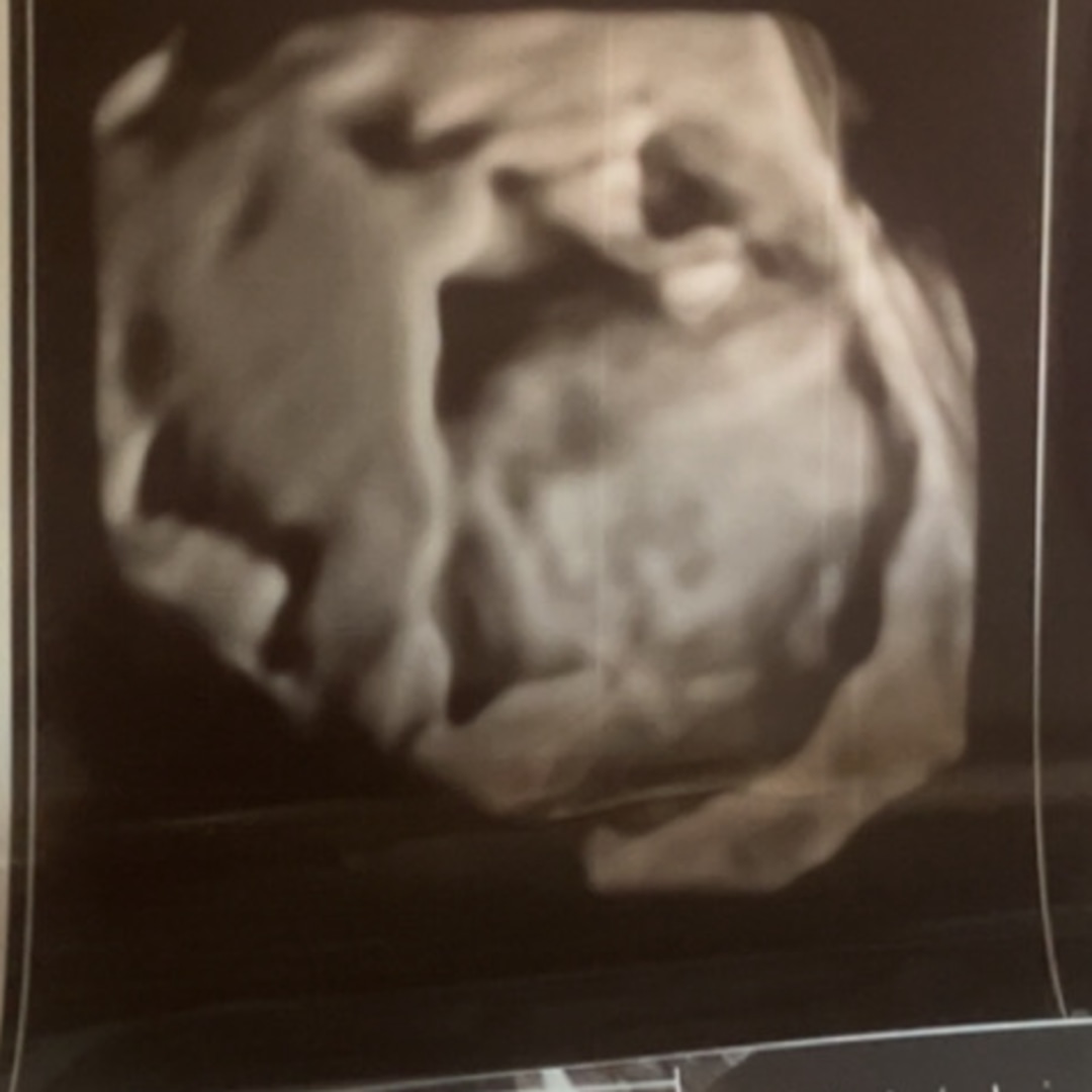 Photo shared by Amayah for their Babylist baby registry.