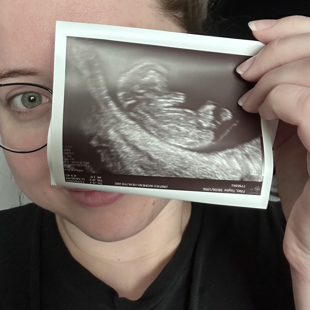 Photo shared by Taylor for their Babylist baby registry.