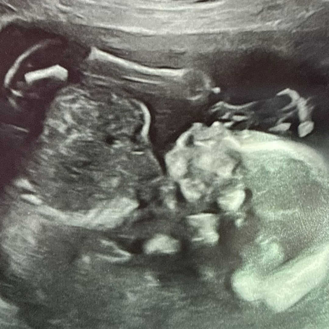 Photo shared by Amanda for their Babylist baby registry.
