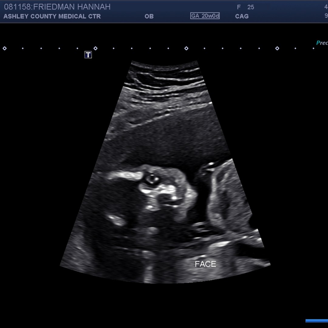 Photo shared by Hannah for their Babylist baby registry.