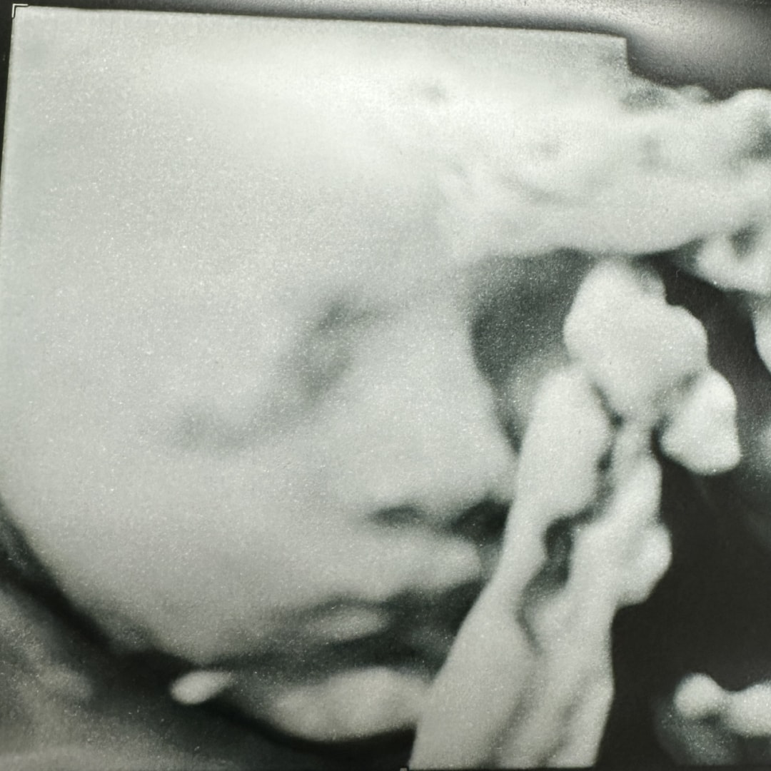 Photo shared by Jocelyn for their Babylist baby registry.