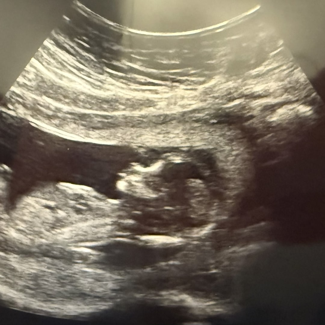 Photo shared by Katlyn for their Babylist baby registry.