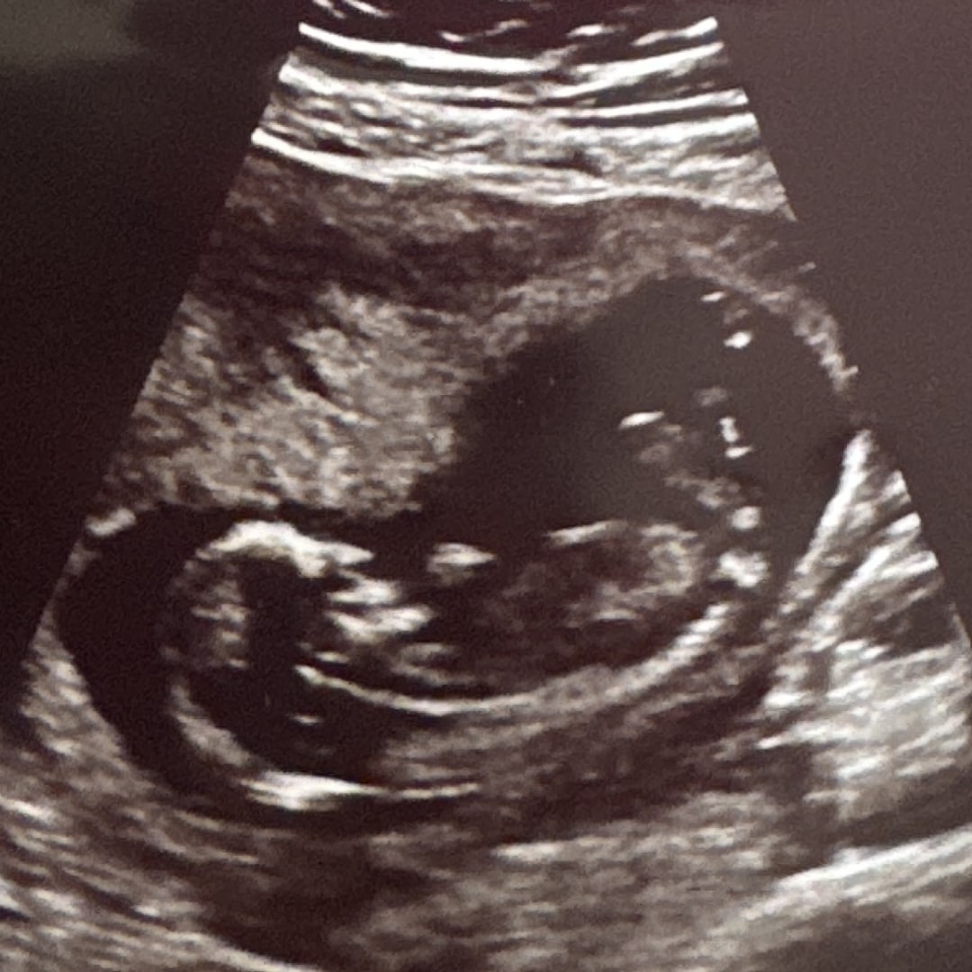 Photo shared by Alexandra for their Babylist baby registry.