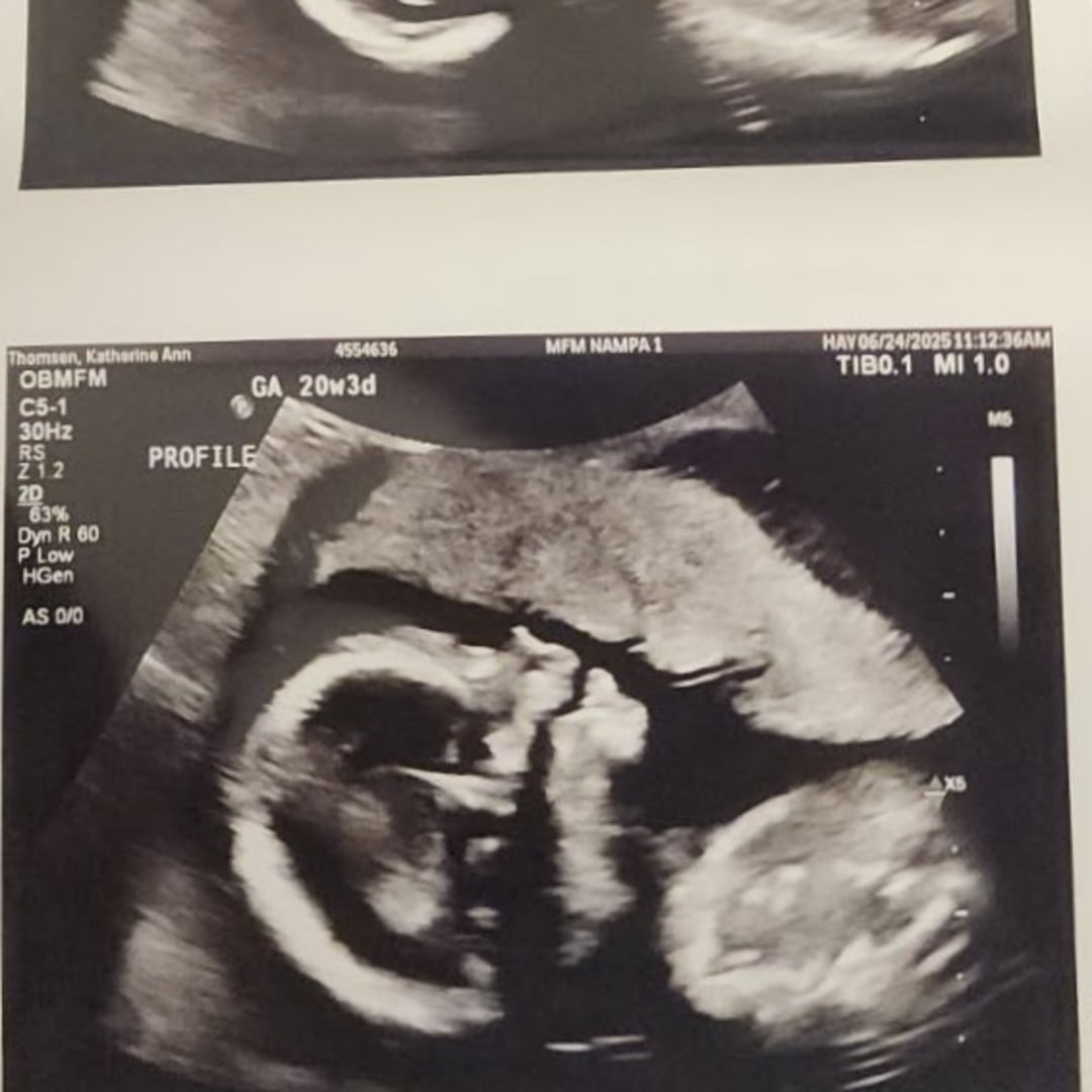 Photo shared by Katie for their Babylist baby registry.