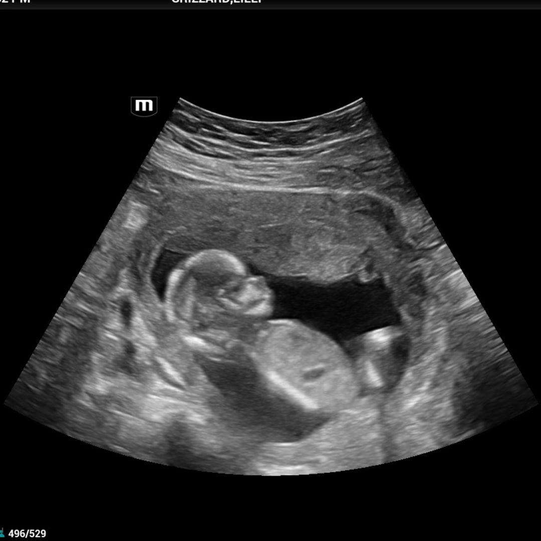 Photo shared by Lilli for their Babylist baby registry.