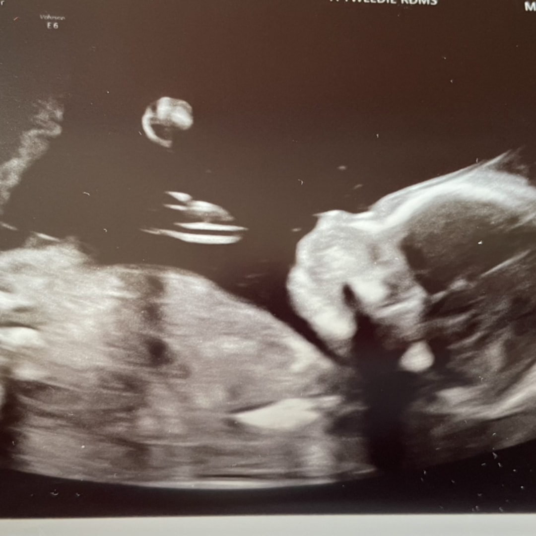 Photo shared by Abby for their Babylist baby registry.