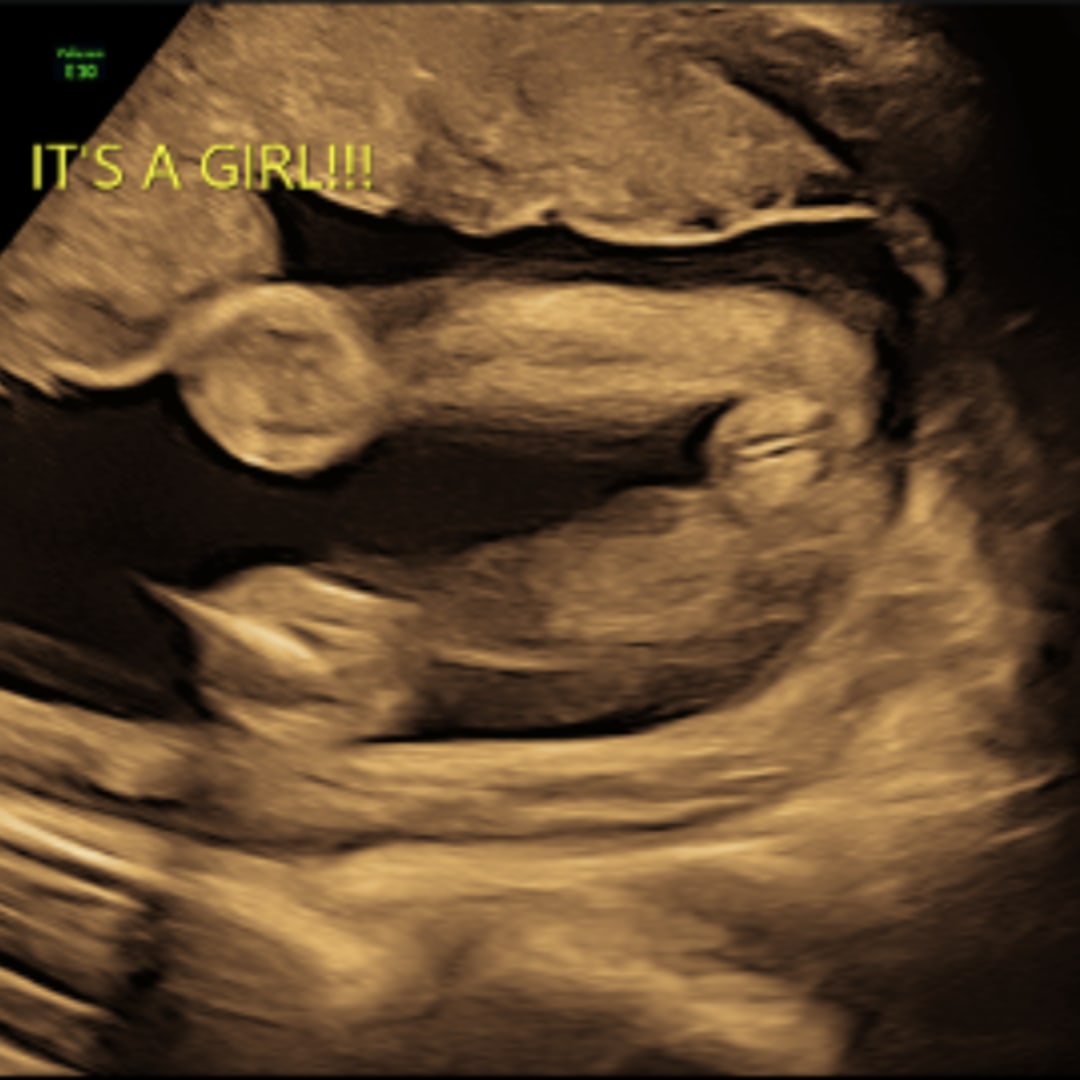 Photo shared by Courtlyn for their Babylist baby registry.