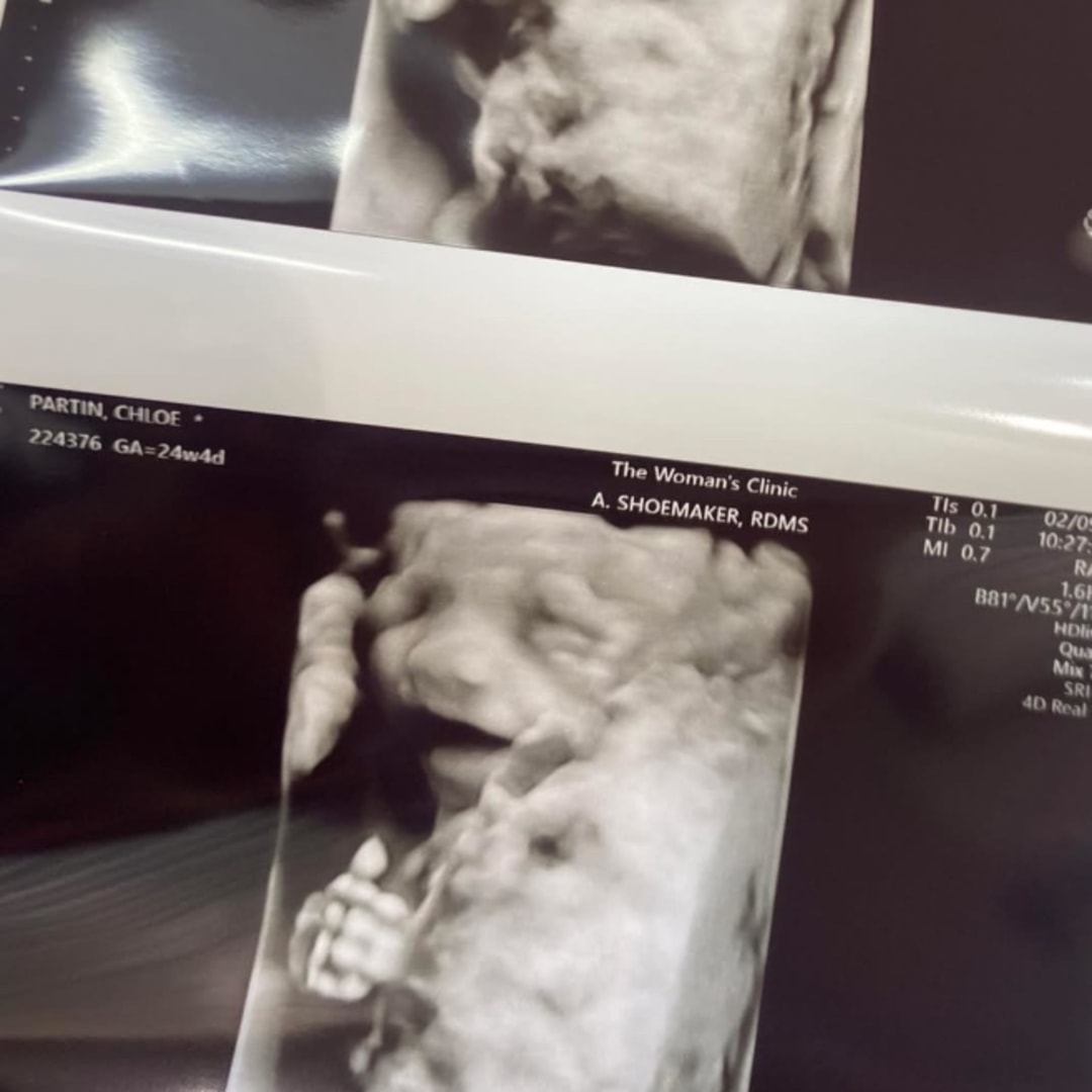 Photo shared by Chloe for their Babylist baby registry.