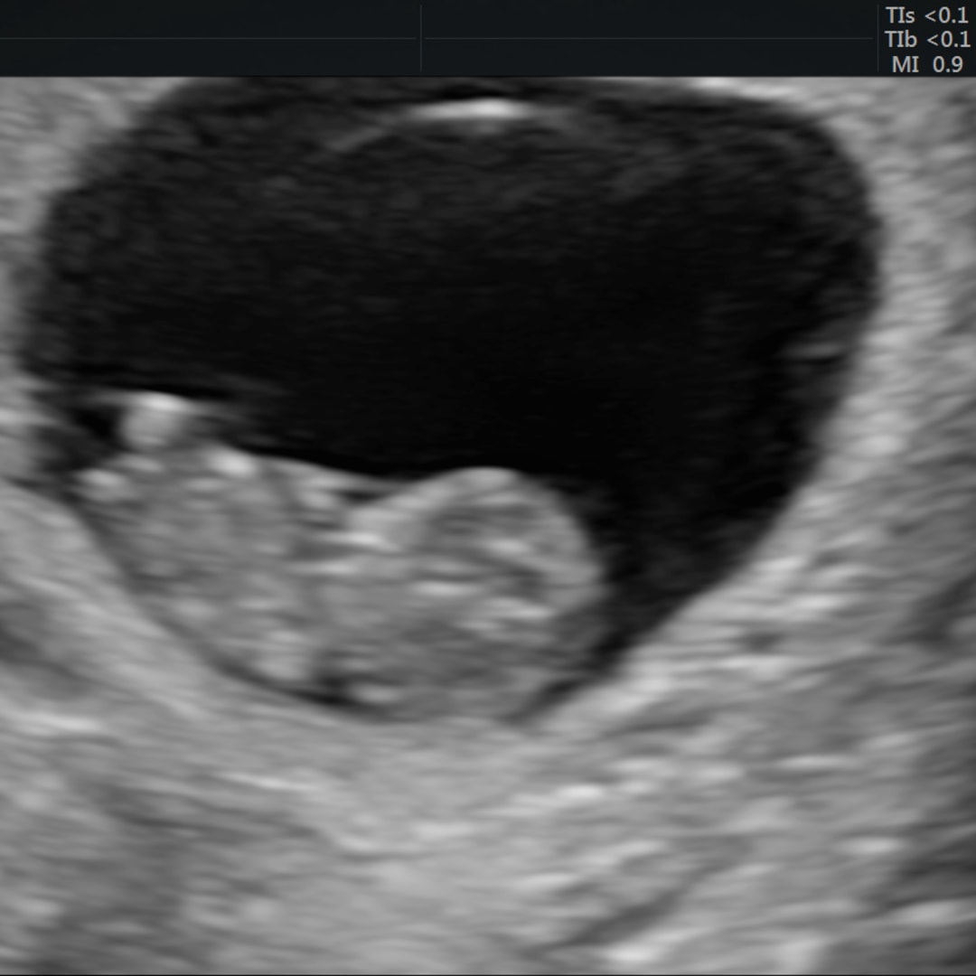 Photo shared by Monique for their Babylist baby registry.