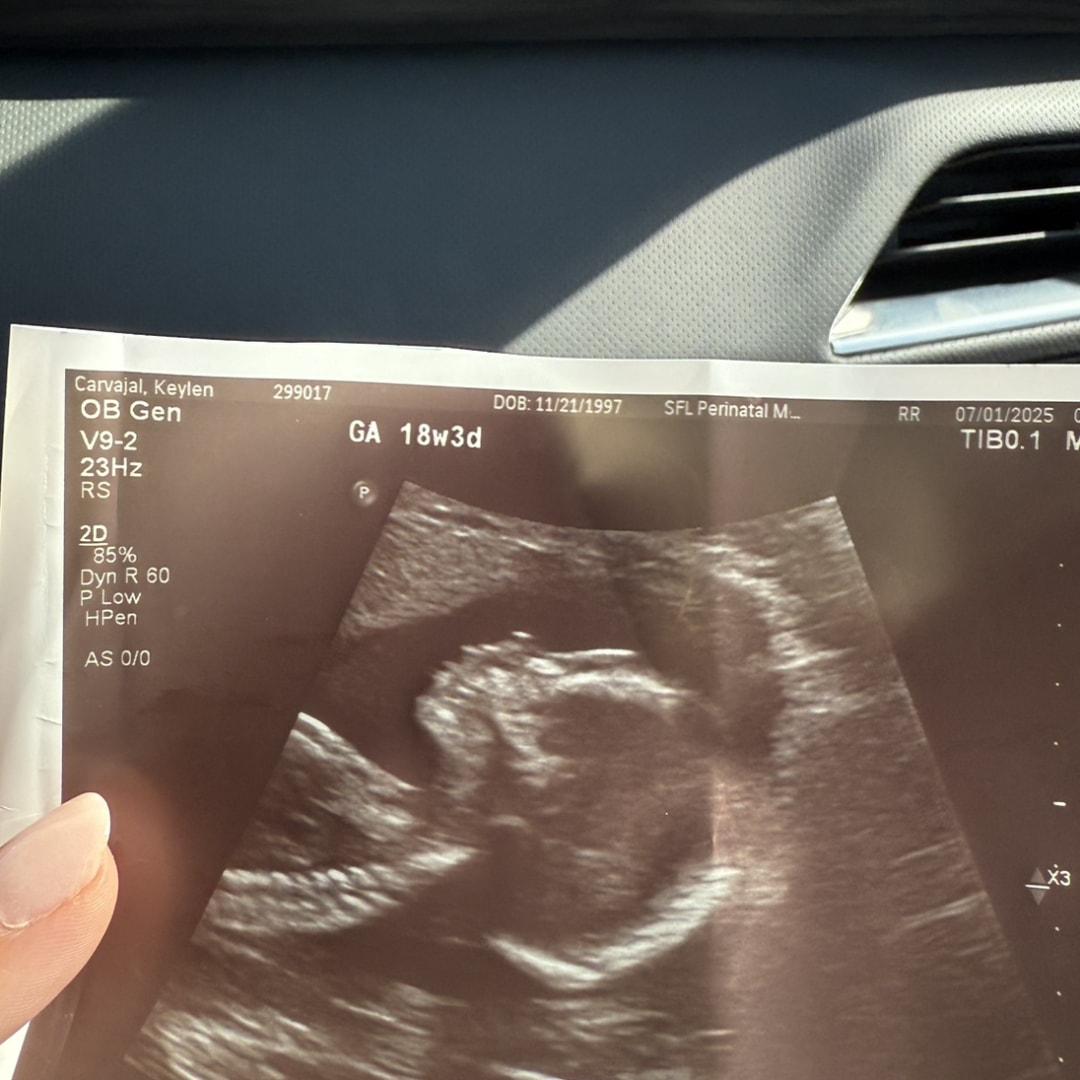 Photo shared by Keylen for their Babylist baby registry.
