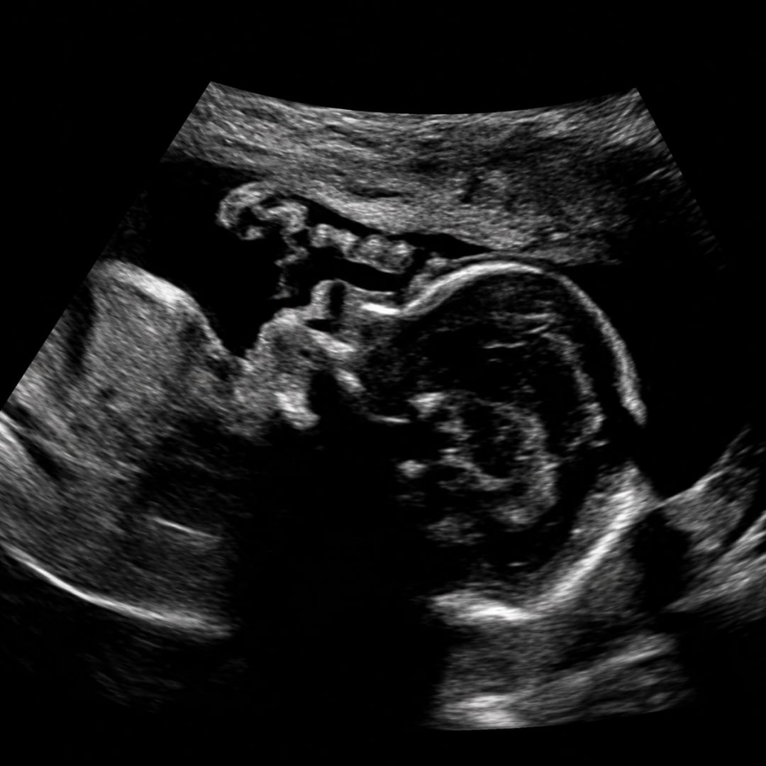Photo shared by Elizabeth for their Babylist baby registry.