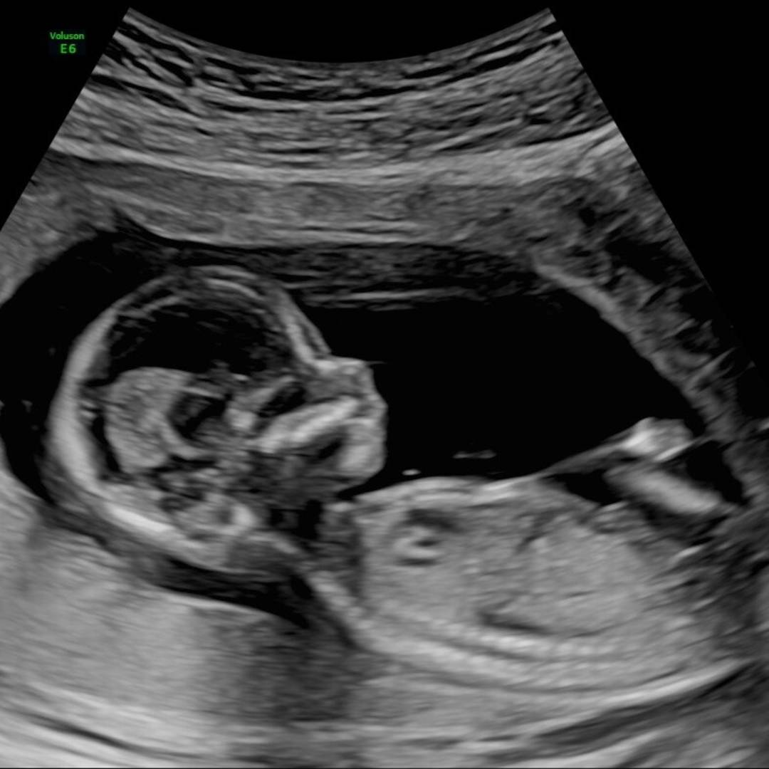 Photo shared by Leslie for their Babylist baby registry.