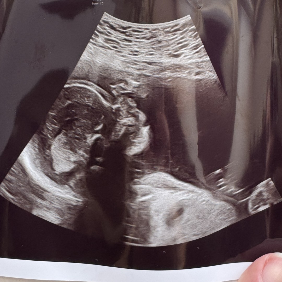 Photo shared by Olivia for their Babylist baby registry.