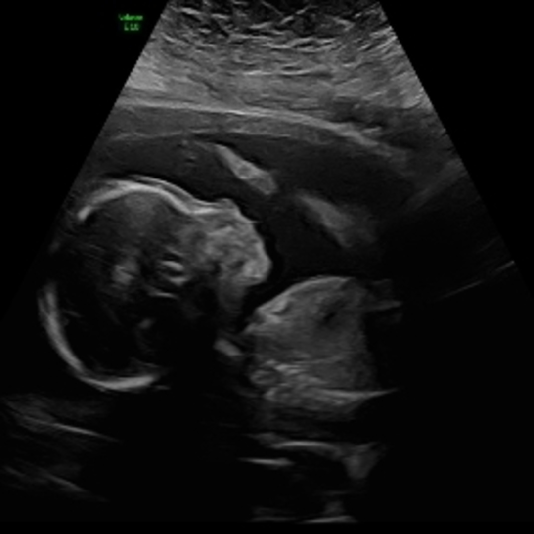 Photo shared by Sarah for their Babylist baby registry.