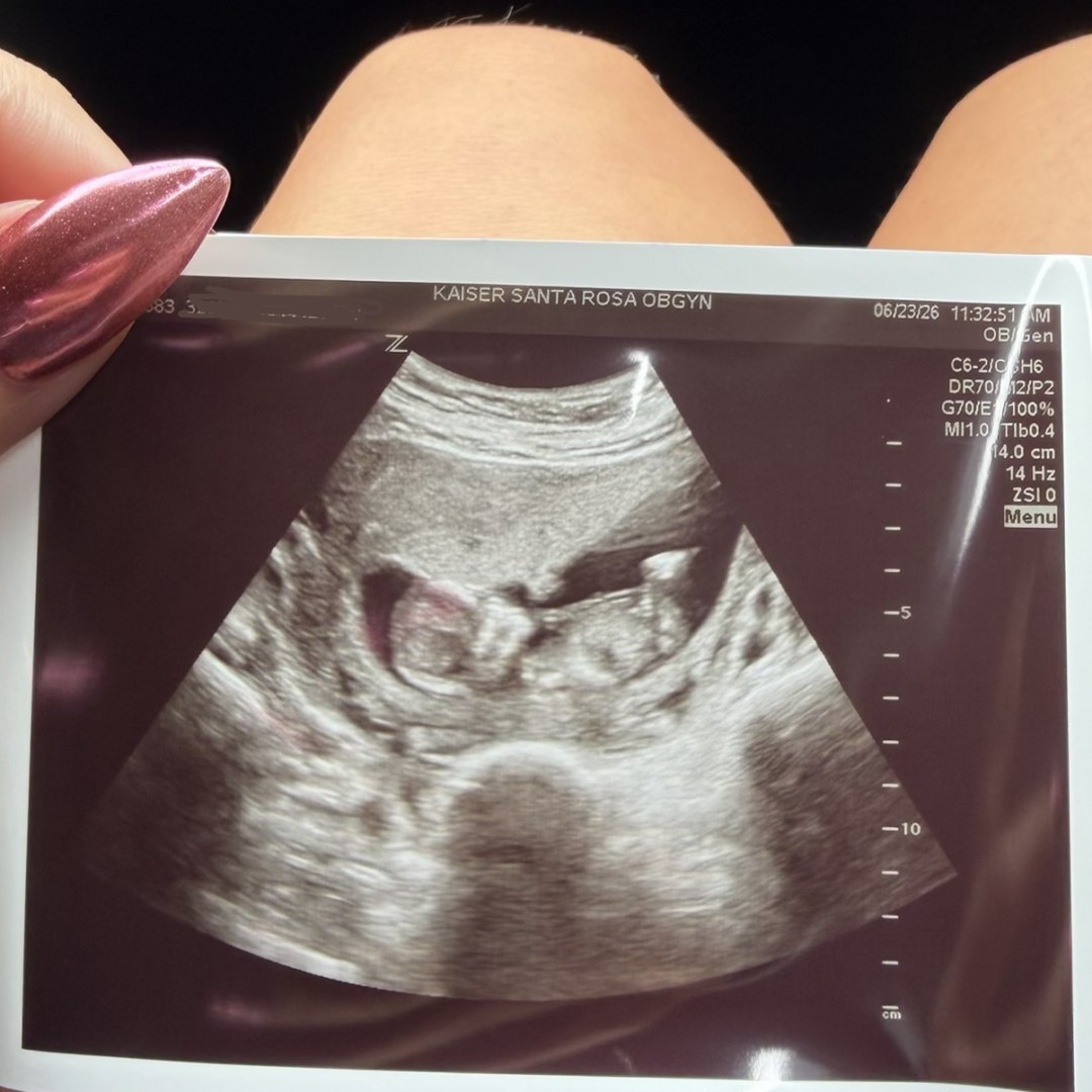 Photo shared by Alyssa for their Babylist baby registry.