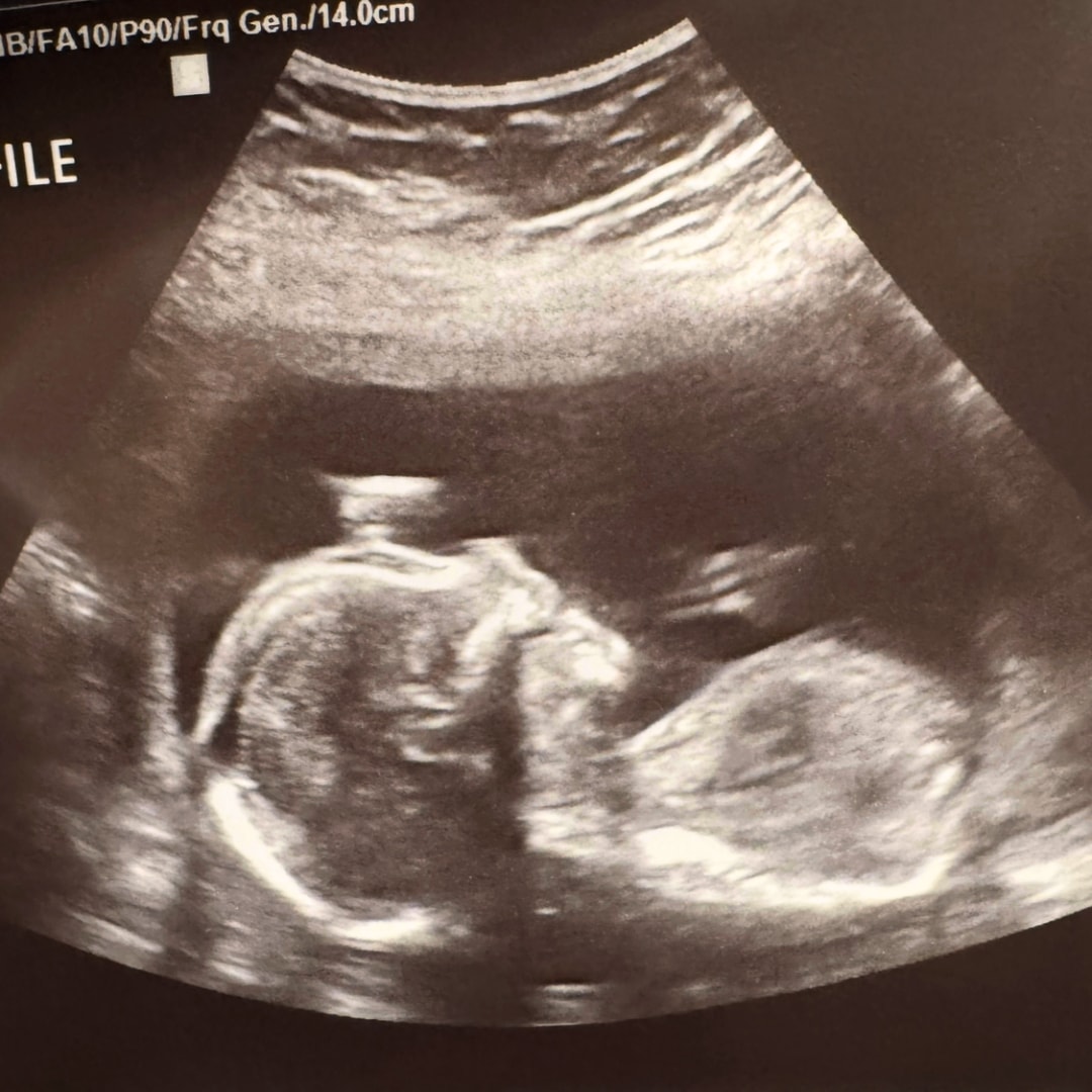 Photo shared by Madison for their Babylist baby registry.