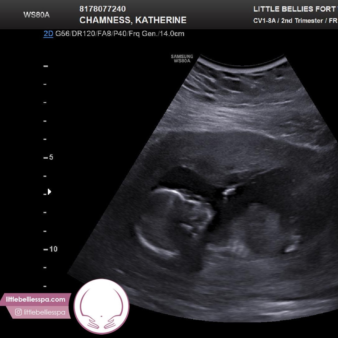 Photo shared by Katie for their Babylist baby registry.