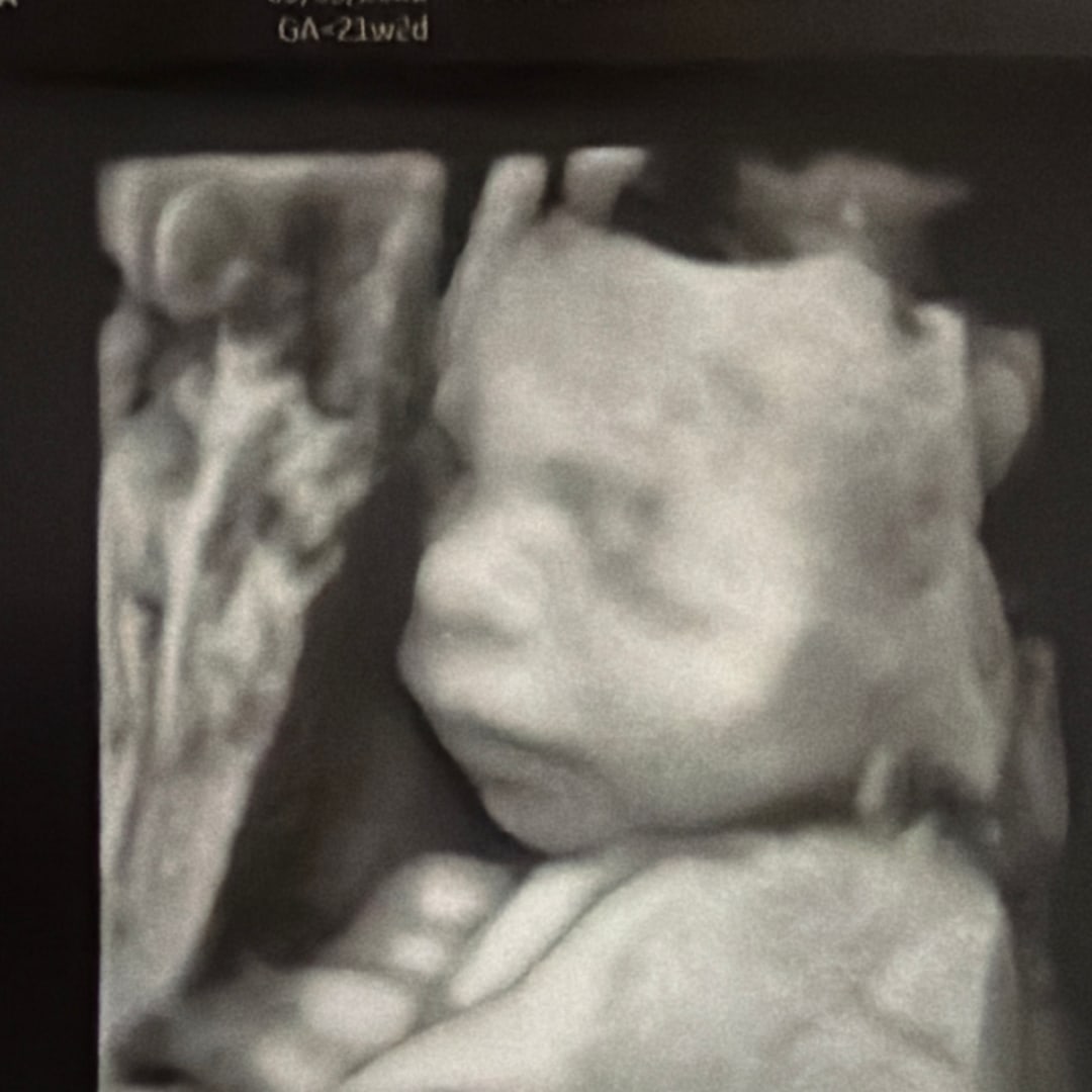 Photo shared by Alexia for their Babylist baby registry.