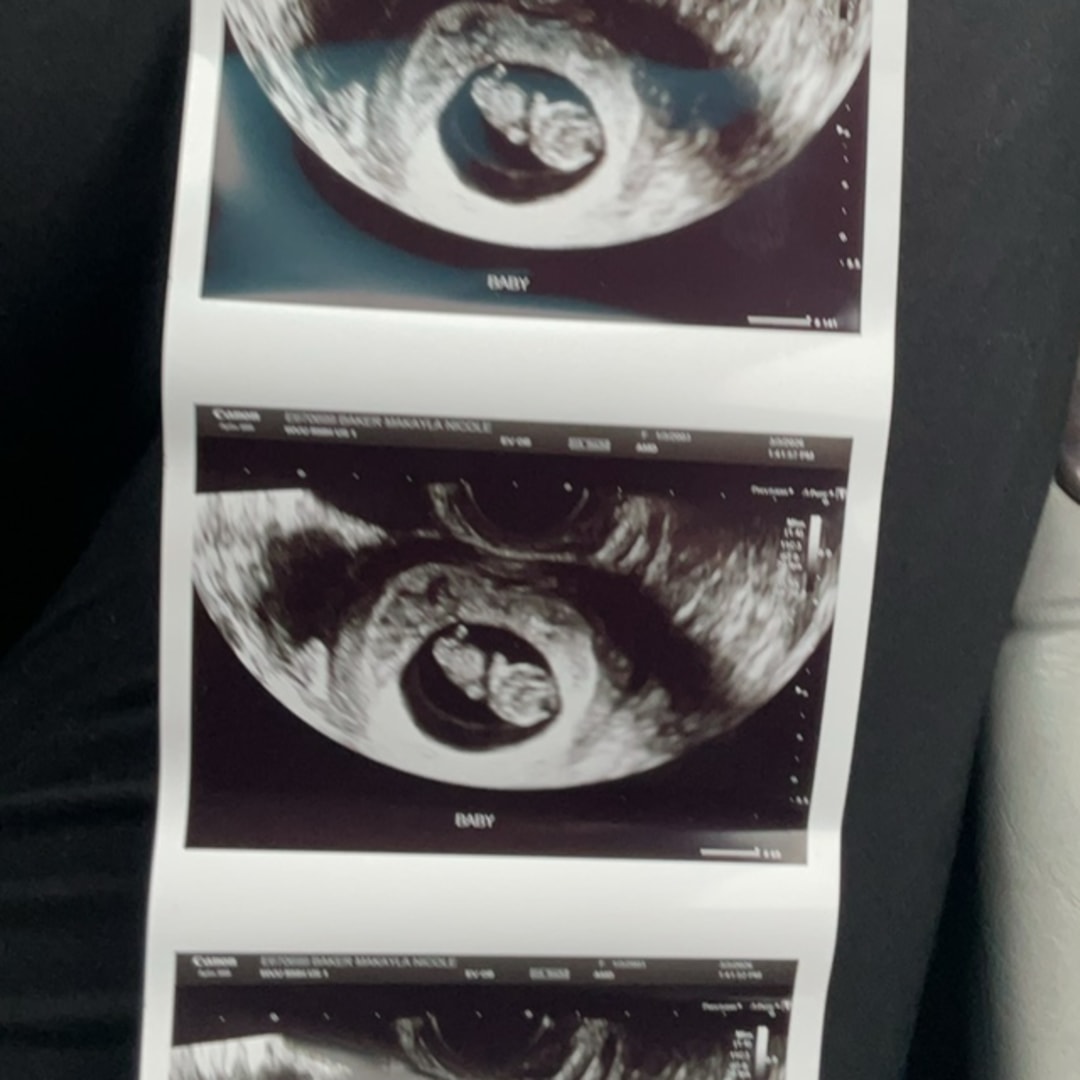 Photo shared by Makayla for their Babylist baby registry.