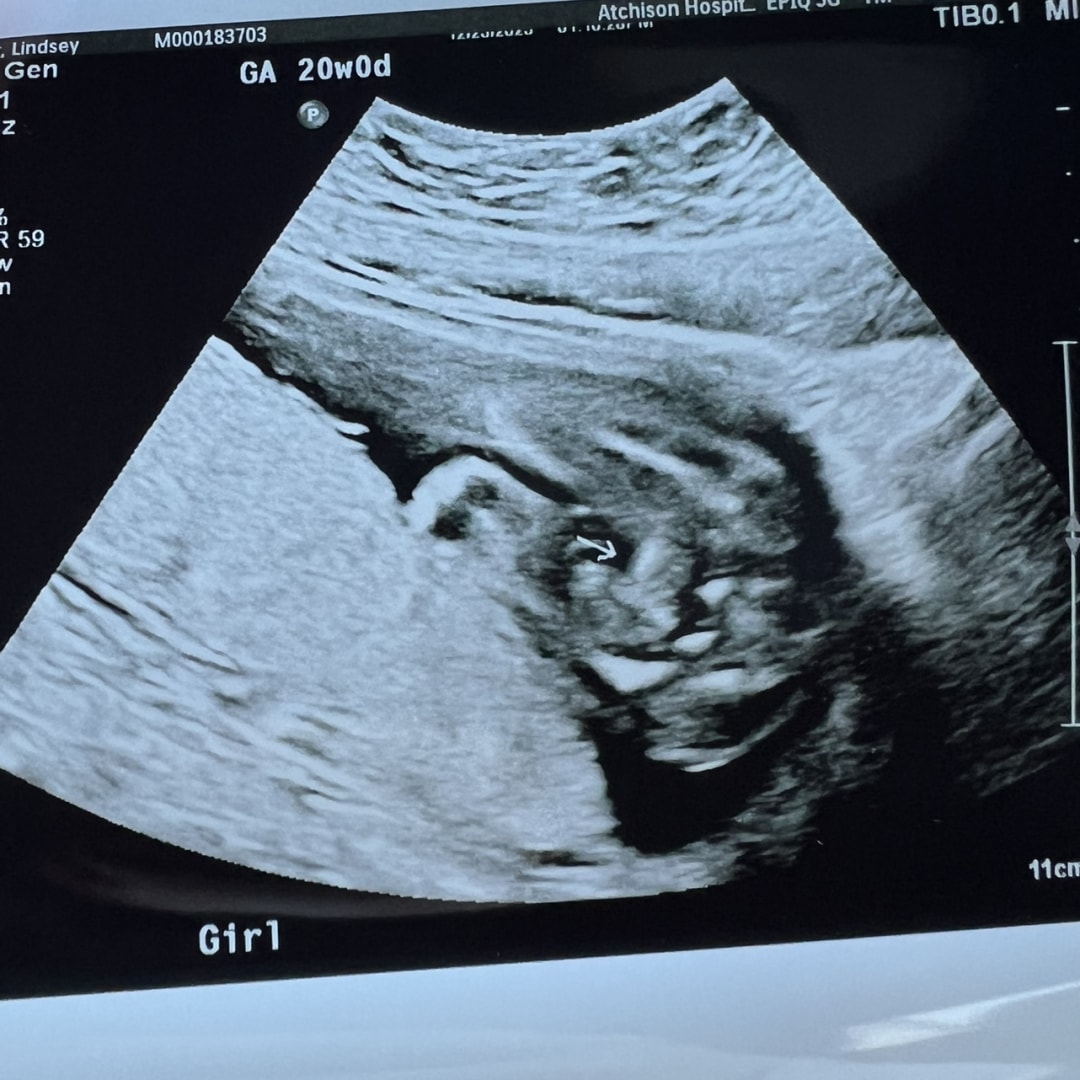 Photo shared by Lindsey for their Babylist baby registry.