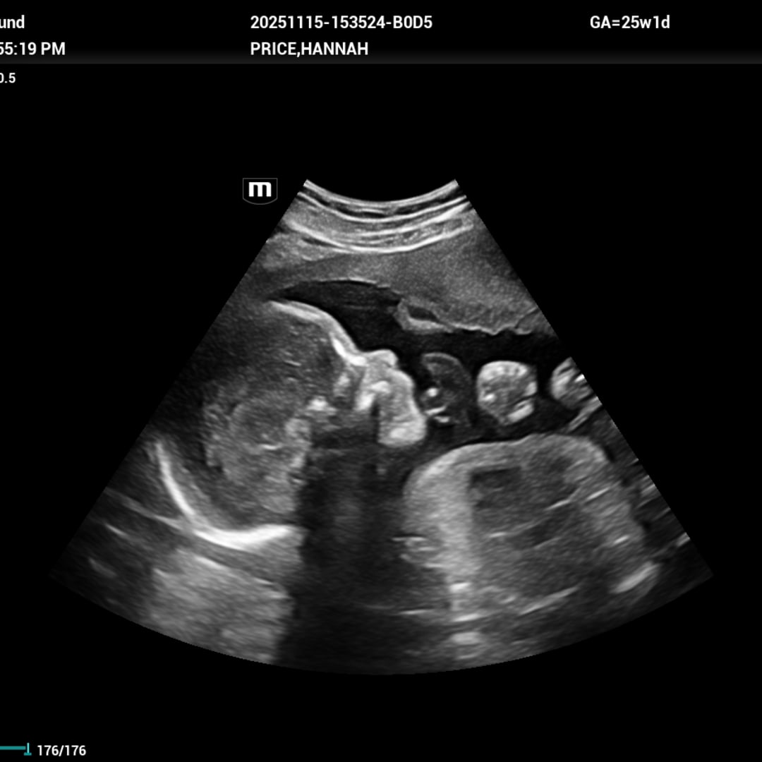 Photo shared by Hannah for their Babylist baby registry.