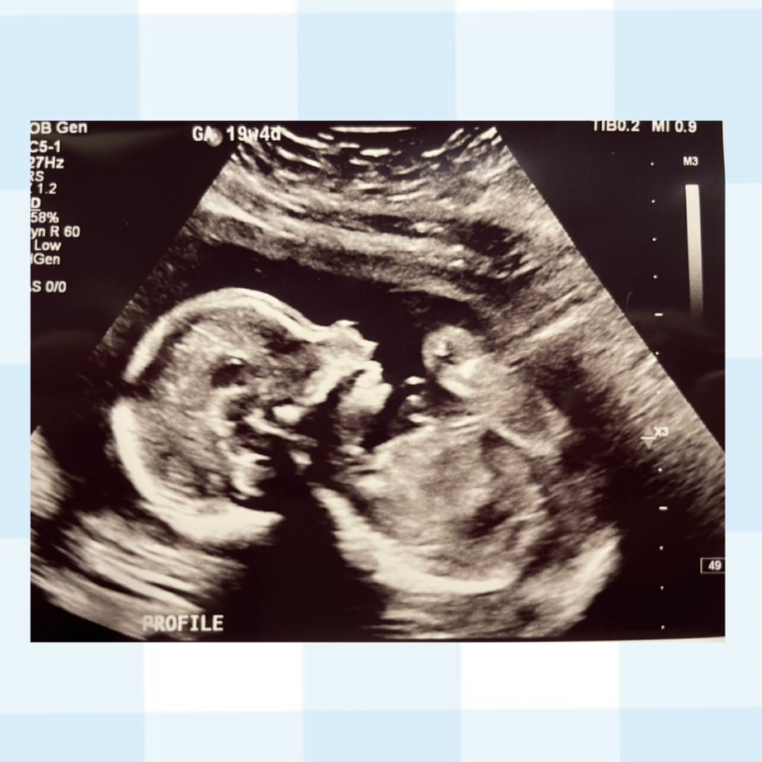 Photo shared by Lauren for their Babylist baby registry.