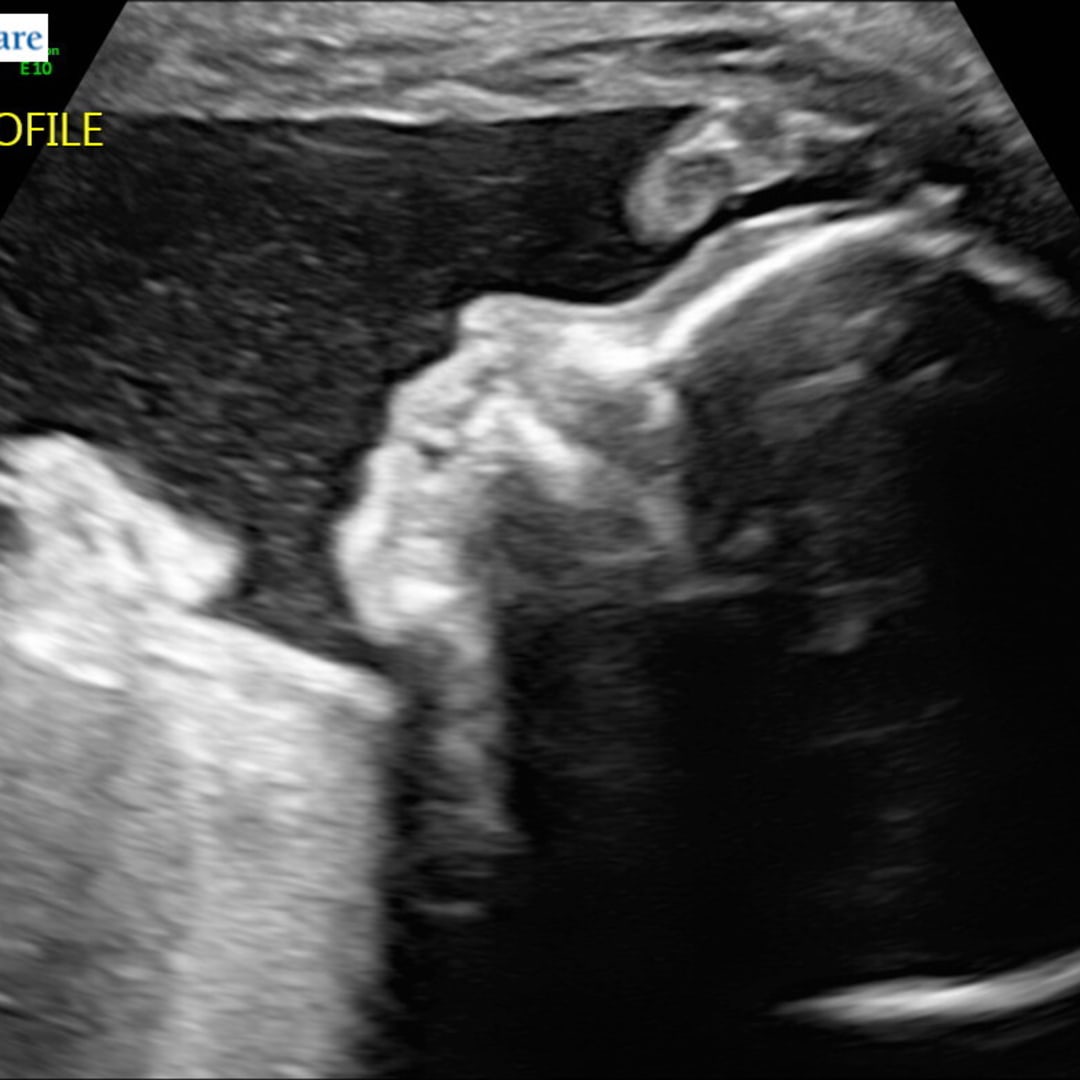 Photo shared by Katie for their Babylist baby registry.