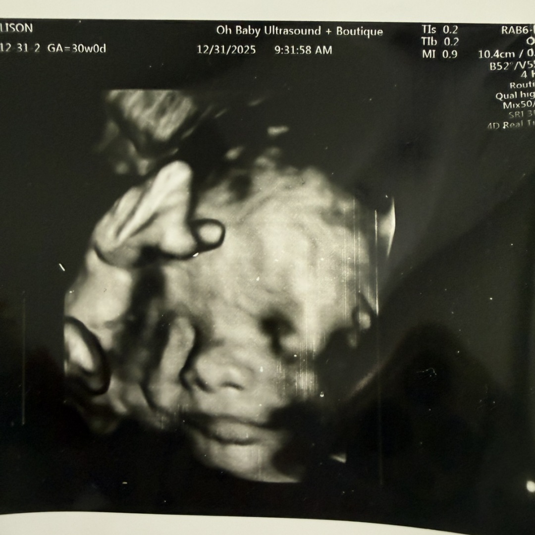 Photo shared by Allison for their Babylist baby registry.