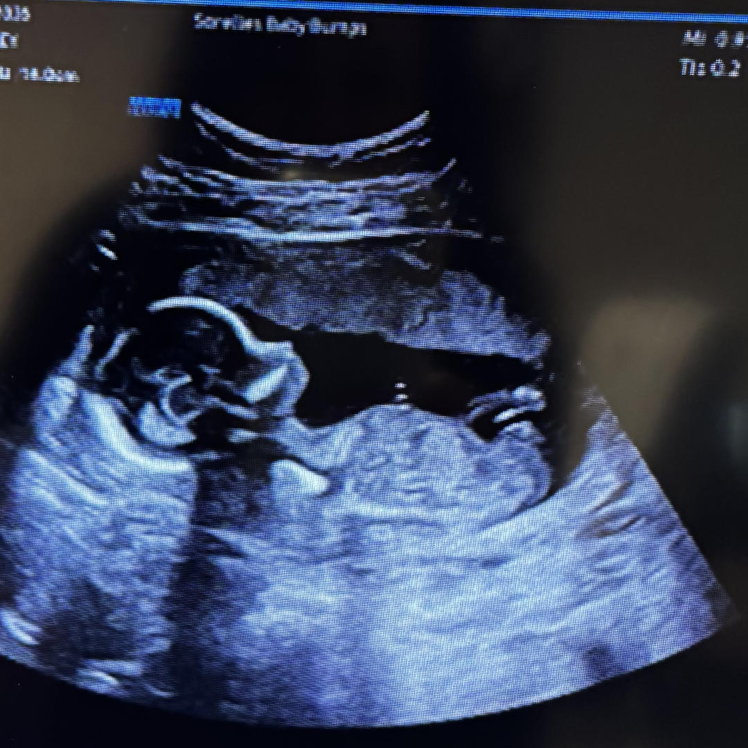 Photo shared by Ashley for their Babylist baby registry.