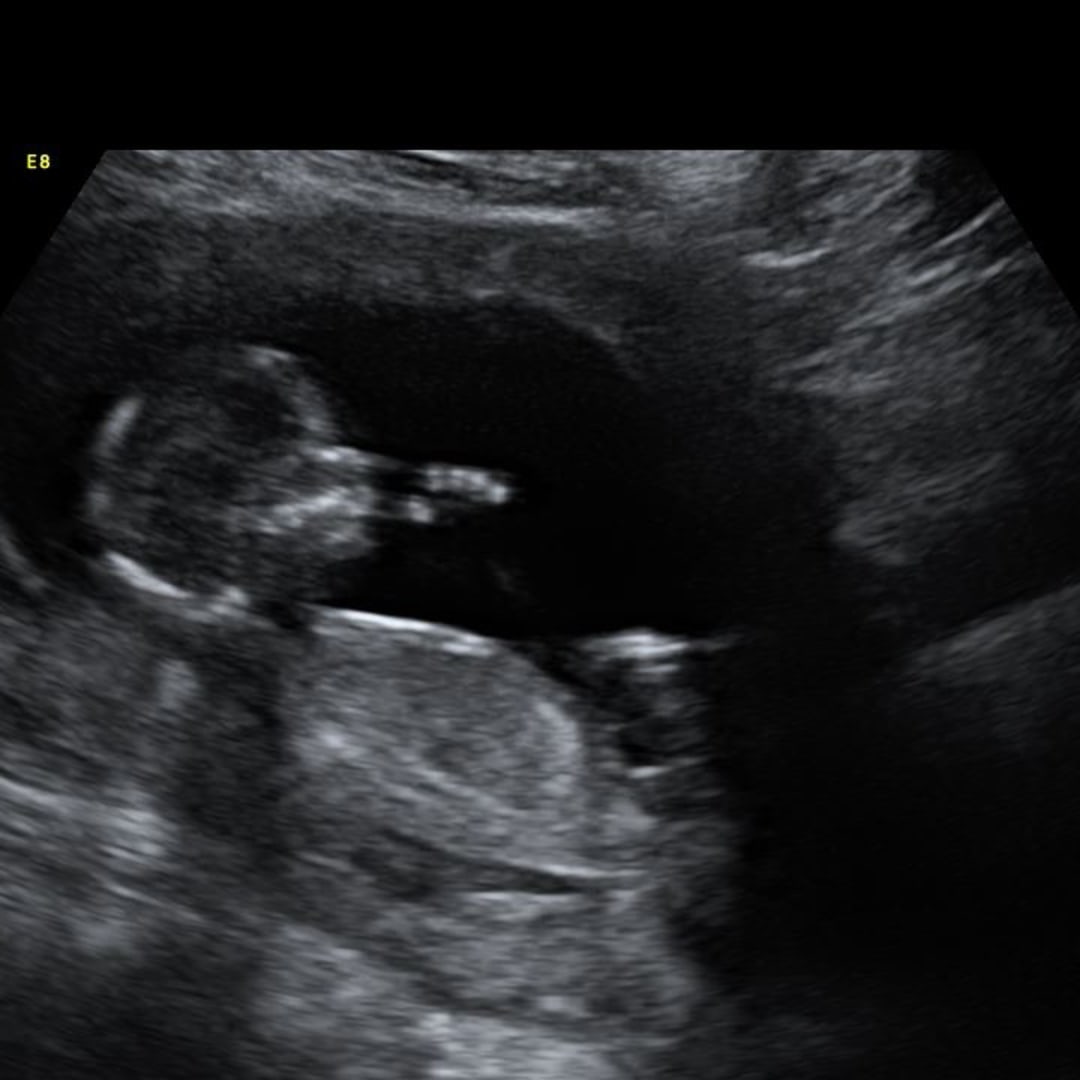 Photo shared by Kaitlynn for their Babylist baby registry.