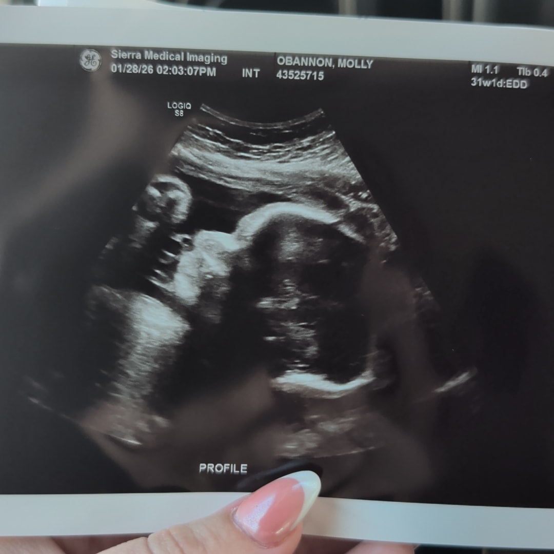Photo shared by Molly for their Babylist baby registry.