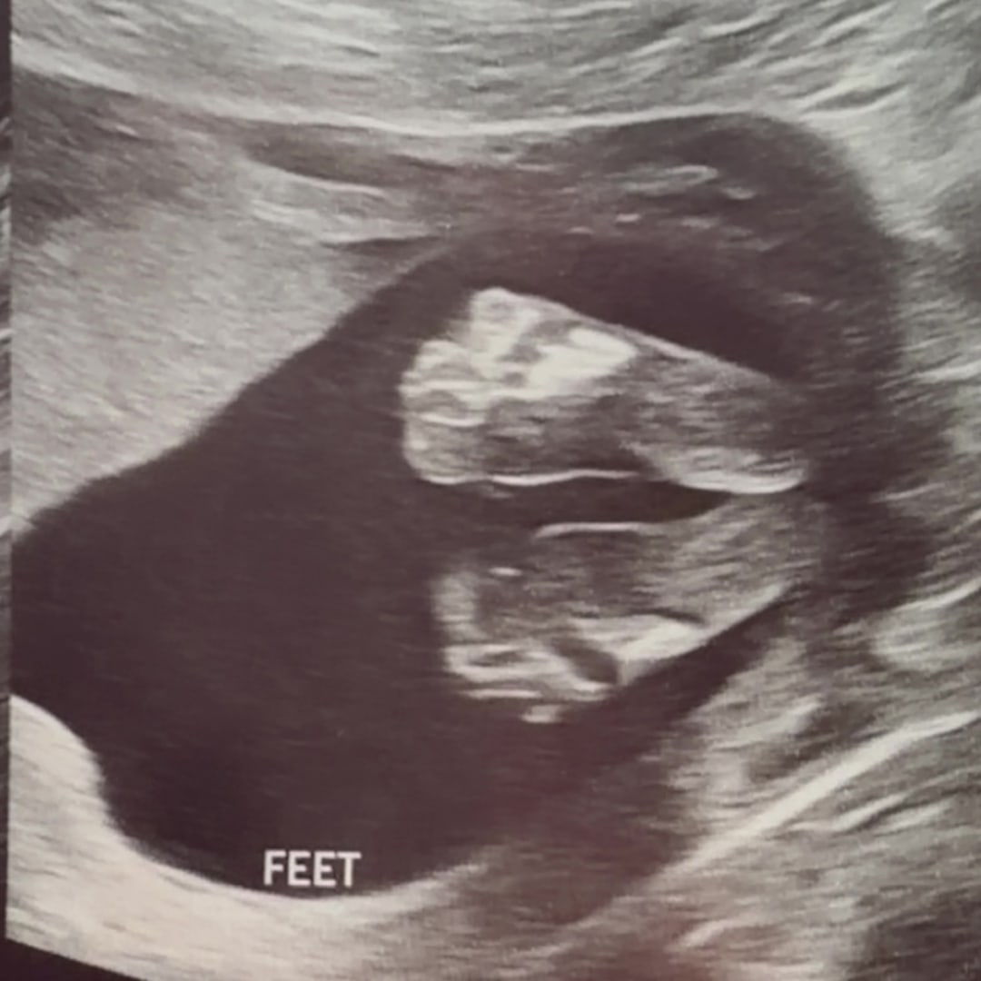 Photo shared by Arlene for their Babylist baby registry.