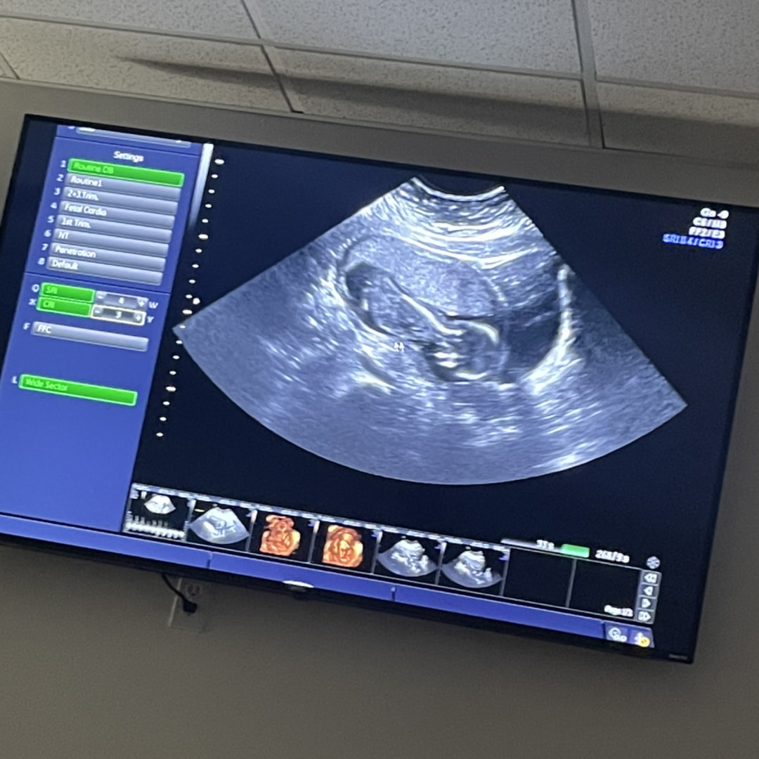 Photo shared by Samantha for their Babylist baby registry.