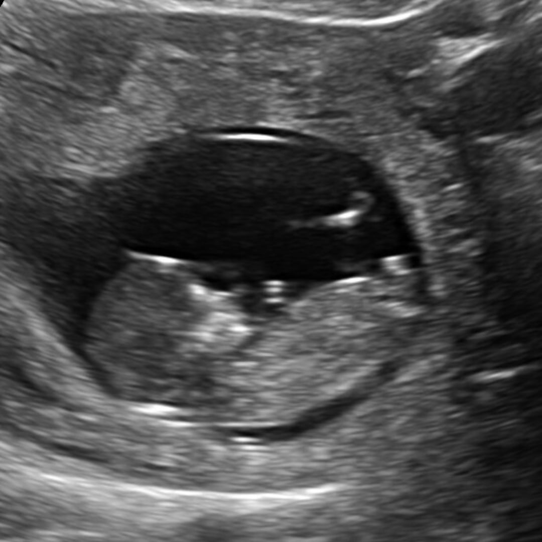 Photo shared by Cheyanne for their Babylist baby registry.