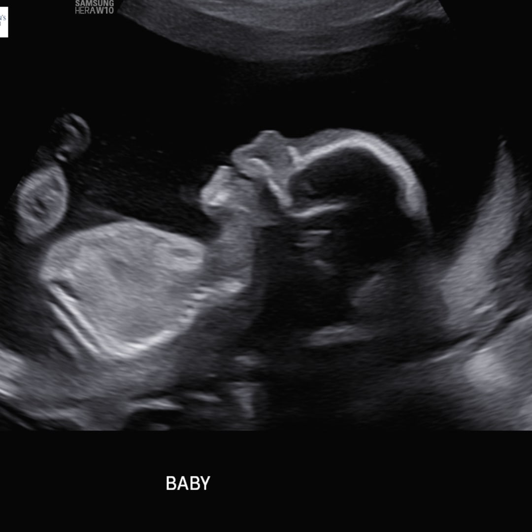 Photo shared by Josie for their Babylist baby registry.