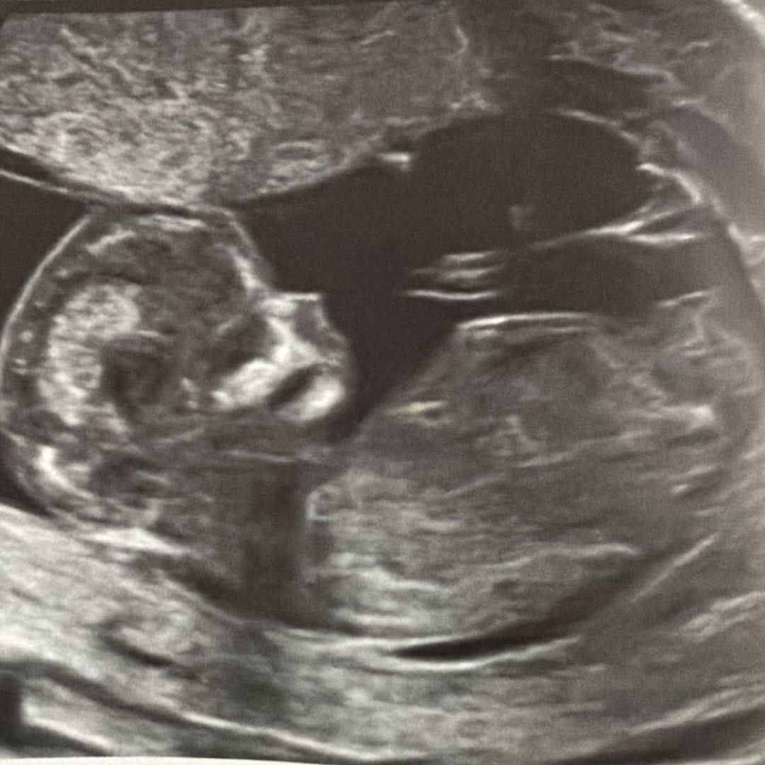 Photo shared by Gaby for their Babylist baby registry.