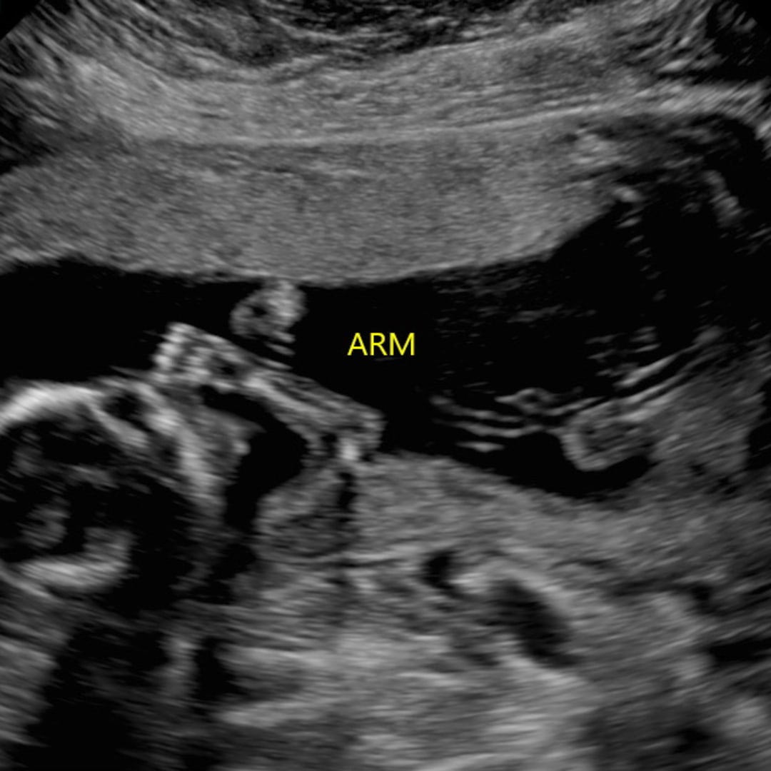 Photo shared by Liz for their Babylist baby registry.