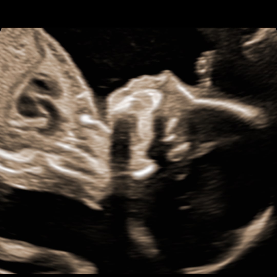Photo shared by Elisabeth for their Babylist baby registry.