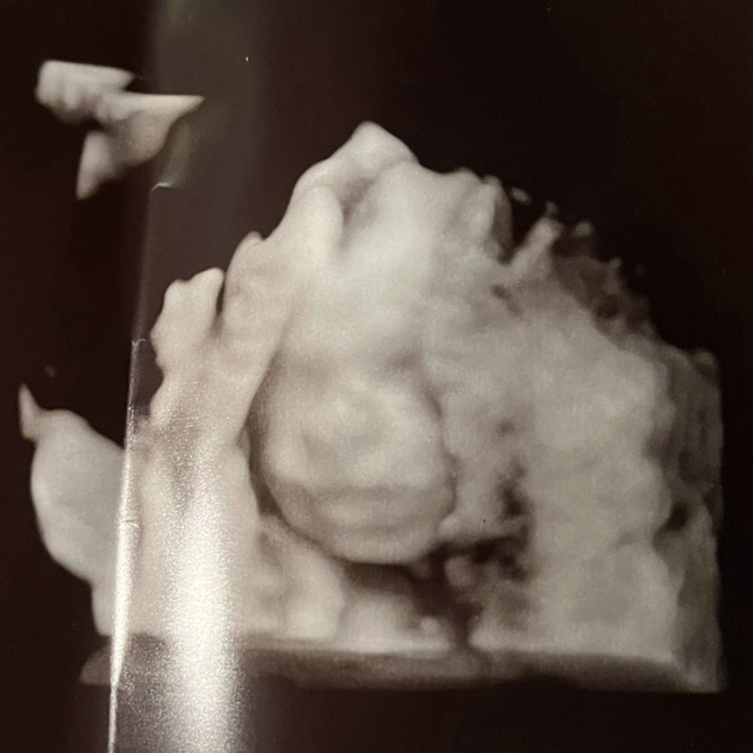 Photo shared by Elis for their Babylist baby registry.
