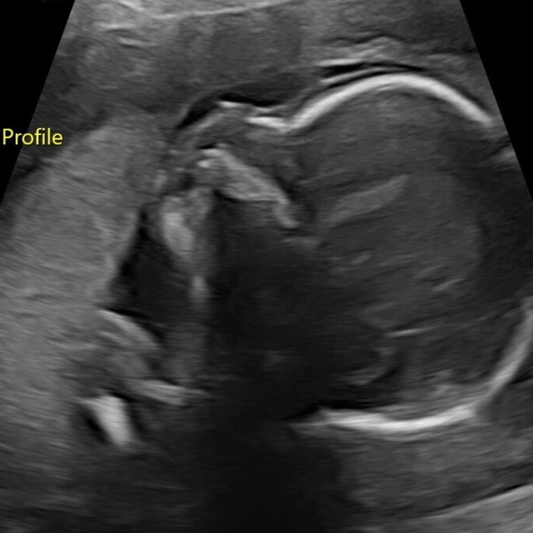 Photo shared by Kyrie for their Babylist baby registry.