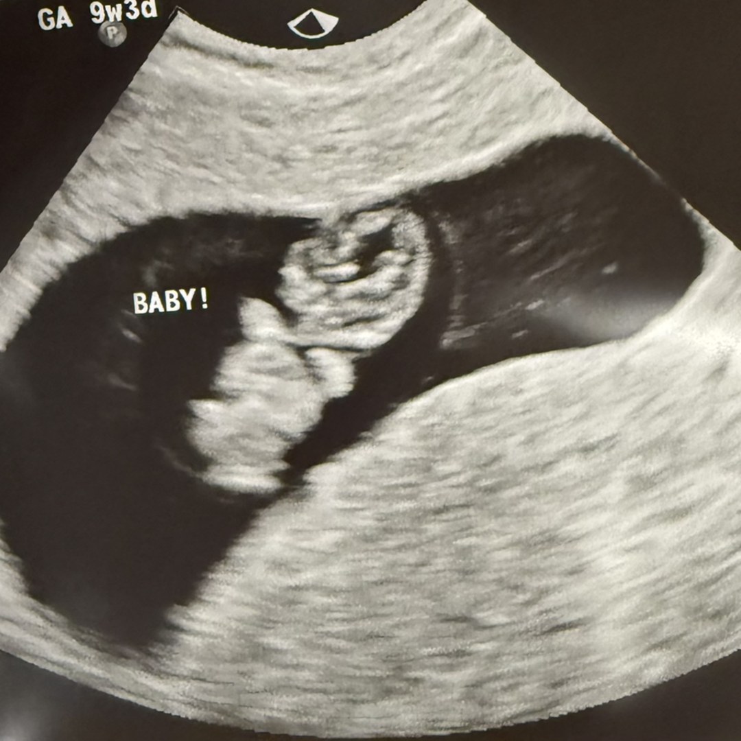 Photo shared by Maddison for their Babylist baby registry.