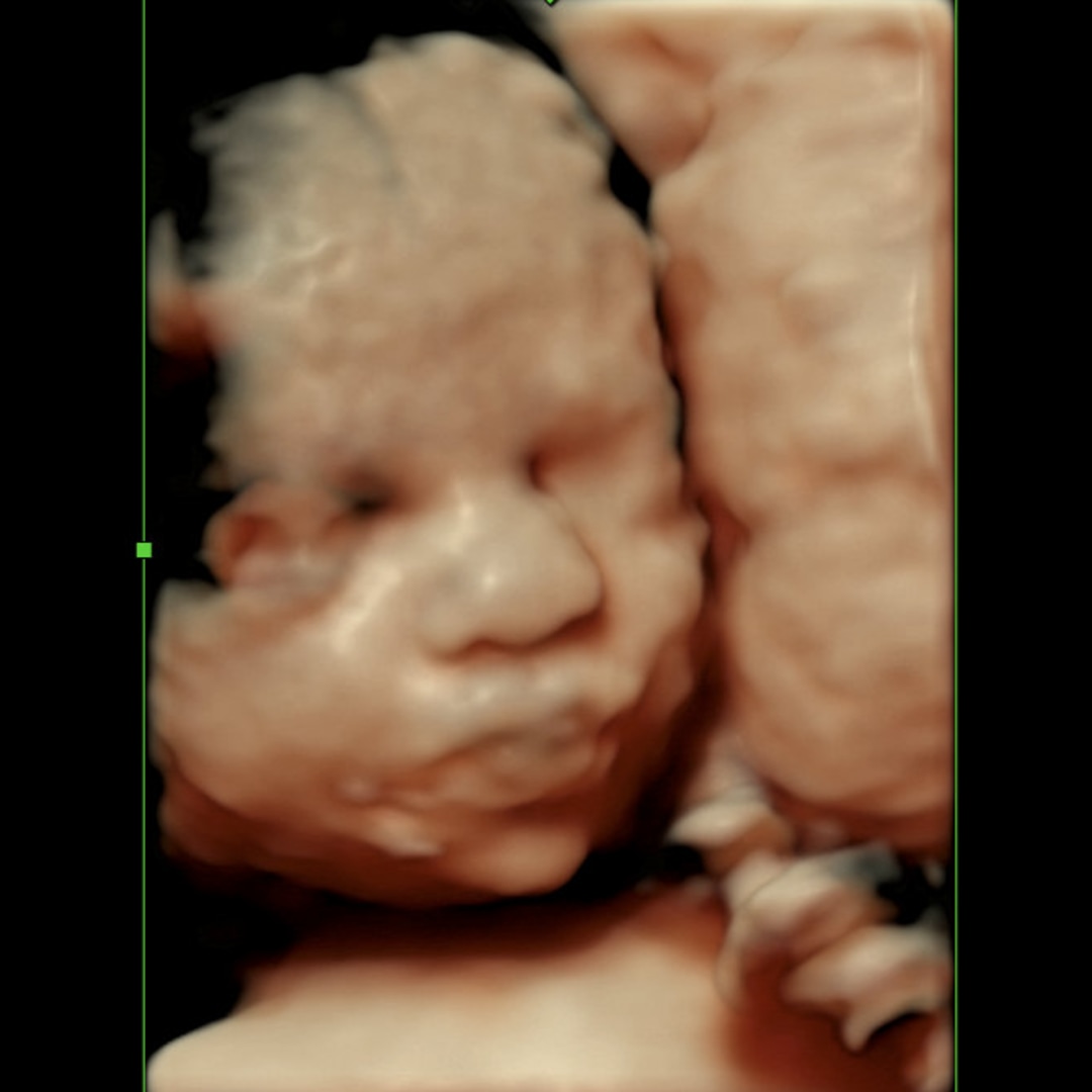 Photo shared by Sarahi for their Babylist baby registry.