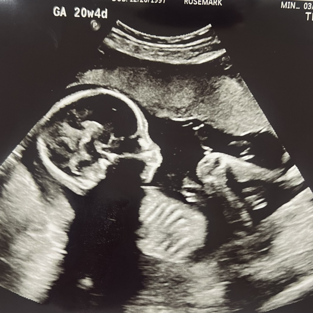 Photo shared by McKadee for their Babylist baby registry.