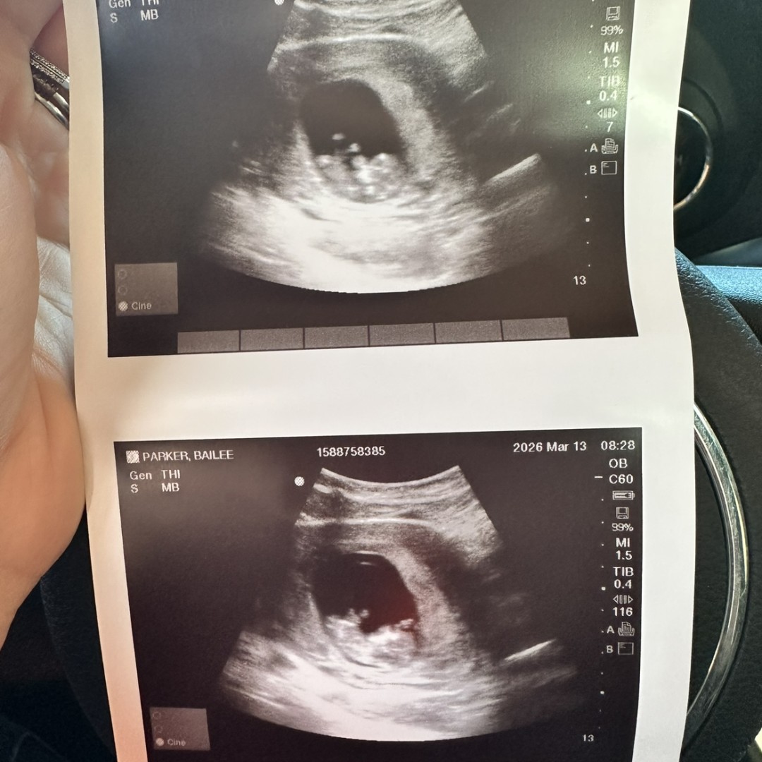 Photo shared by Bailee for their Babylist baby registry.