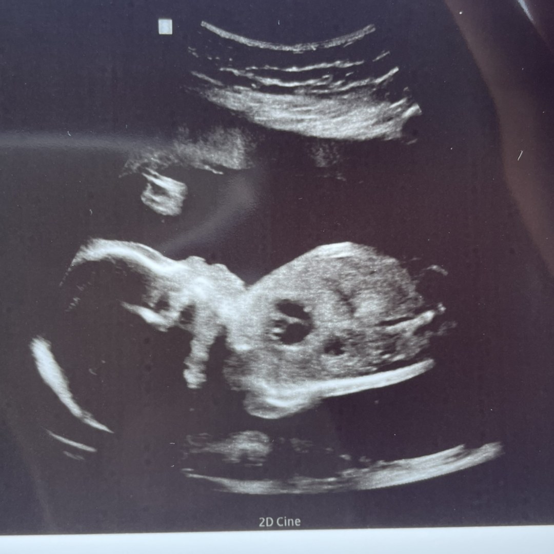 Photo shared by Jordyn for their Babylist baby registry.