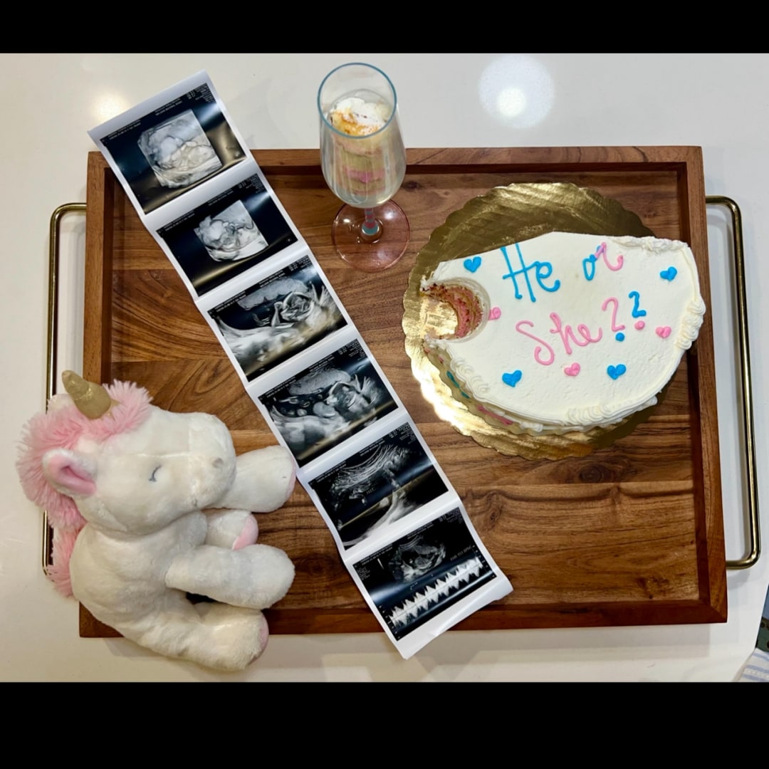 Photo shared by Hannah for their Babylist baby registry.