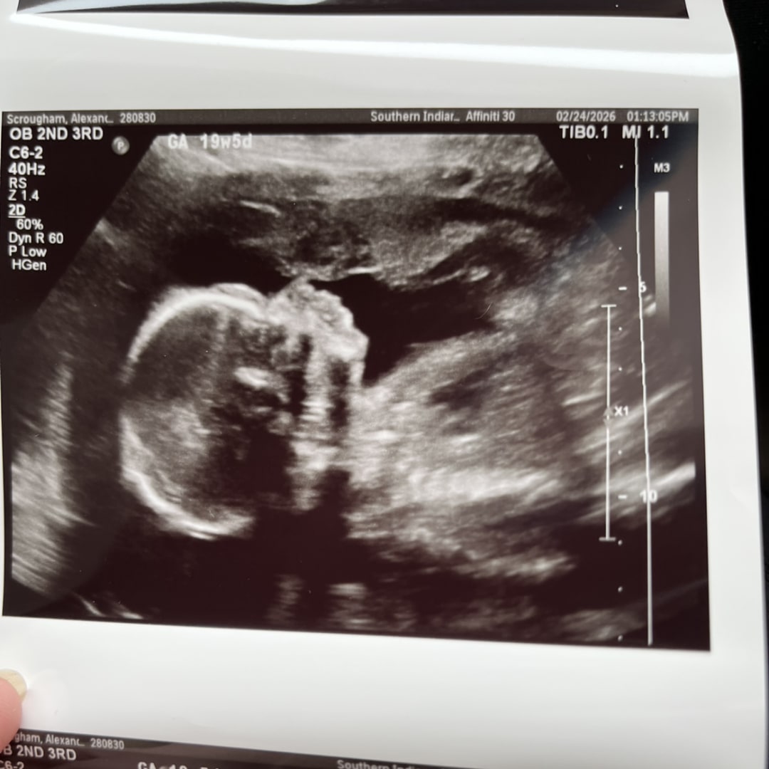 Photo shared by Alexandria for their Babylist baby registry.