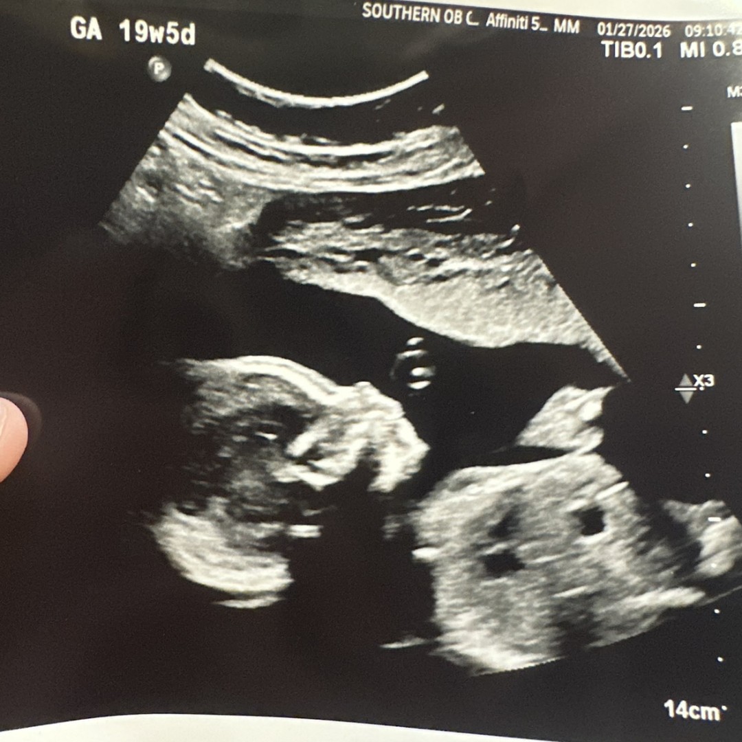 Photo shared by Brooke for their Babylist baby registry.