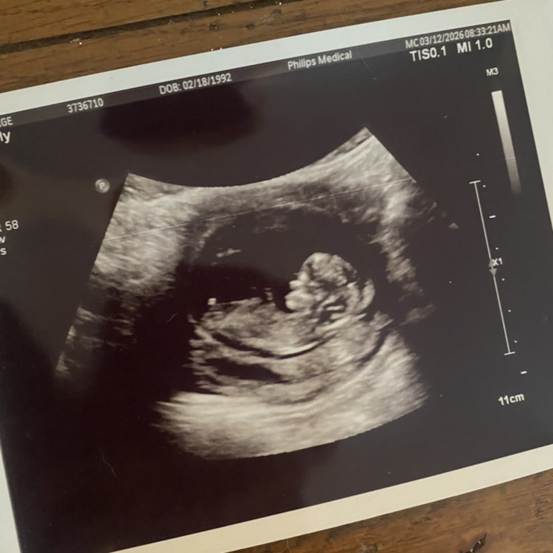 Photo shared by Paige for their Babylist baby registry.